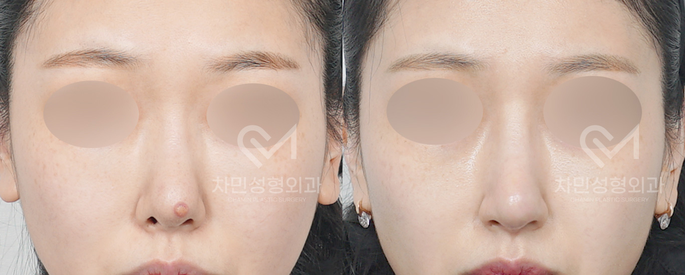 3번째 첨부파일