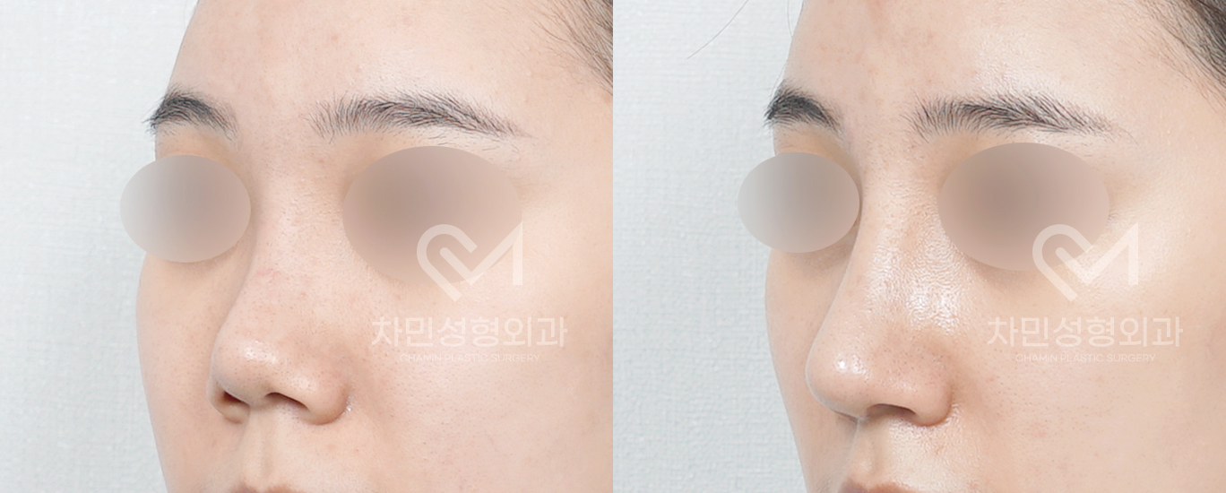 2번째 첨부파일