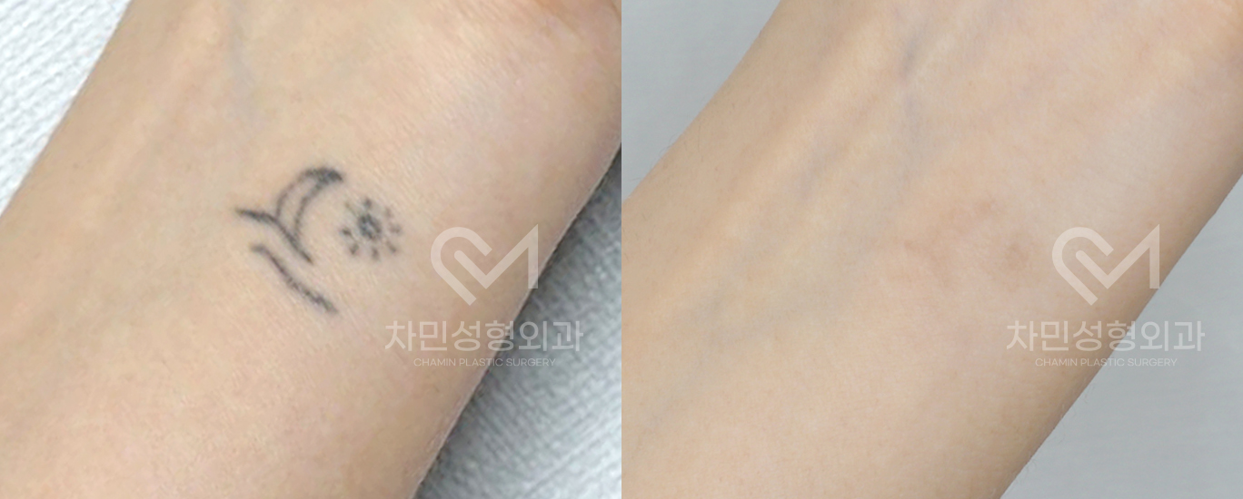 1번째 첨부파일