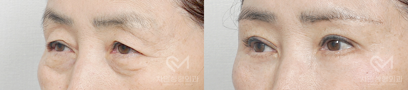 2번째 첨부파일