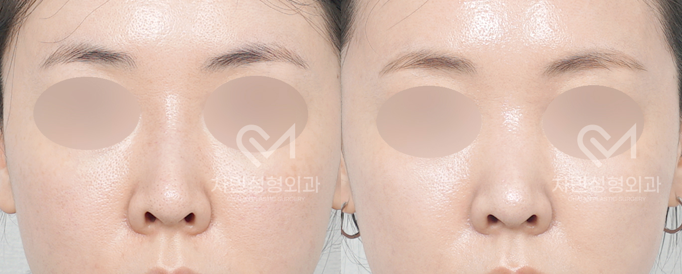 3번째 첨부파일