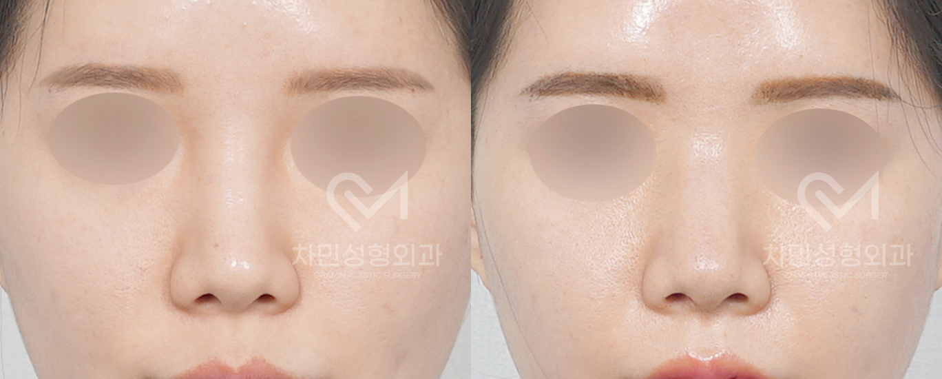 3번째 첨부파일