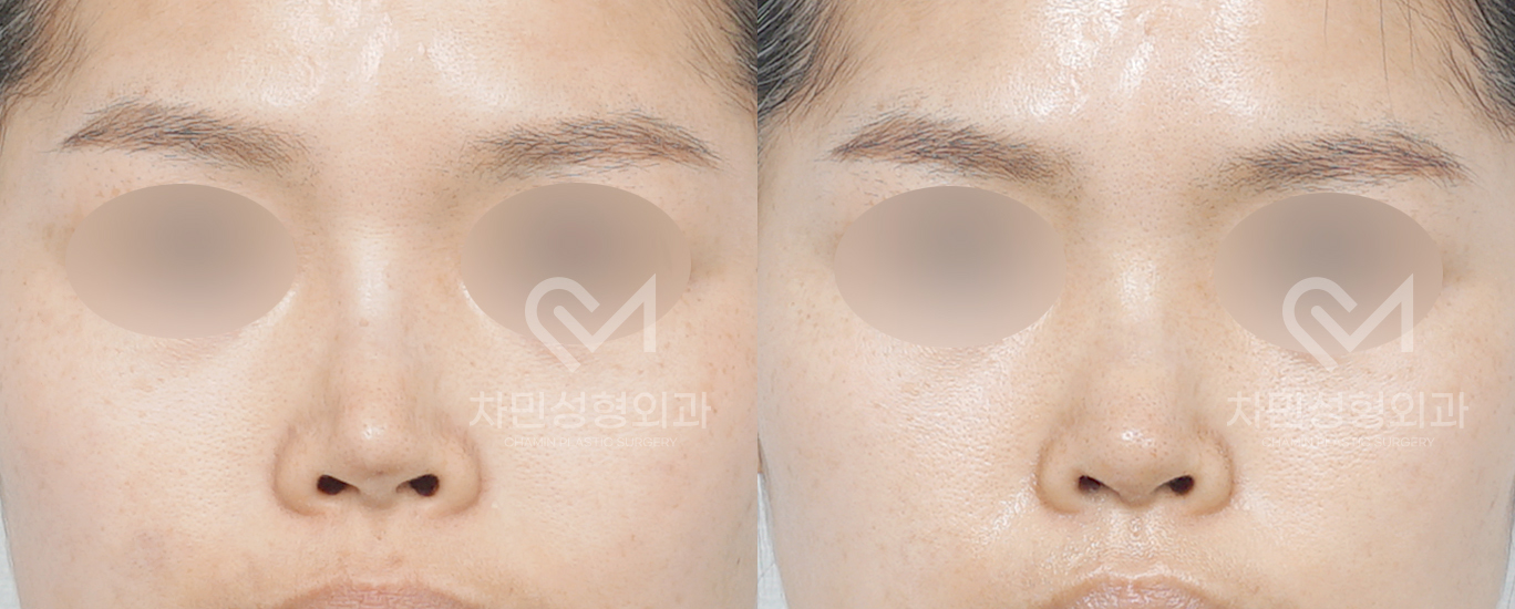 3번째 첨부파일