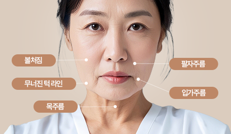 안면거상 이미지
