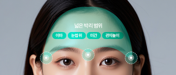 넓은 박리 범위