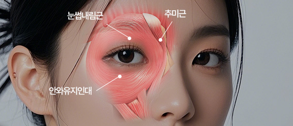 추미근, 눈썹내림근 절제