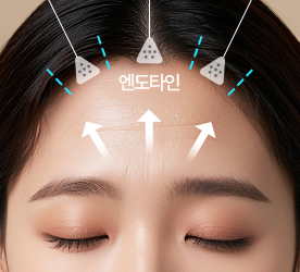step 03