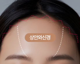 1단계