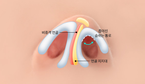 구조적 원인