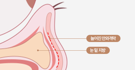 격막강화