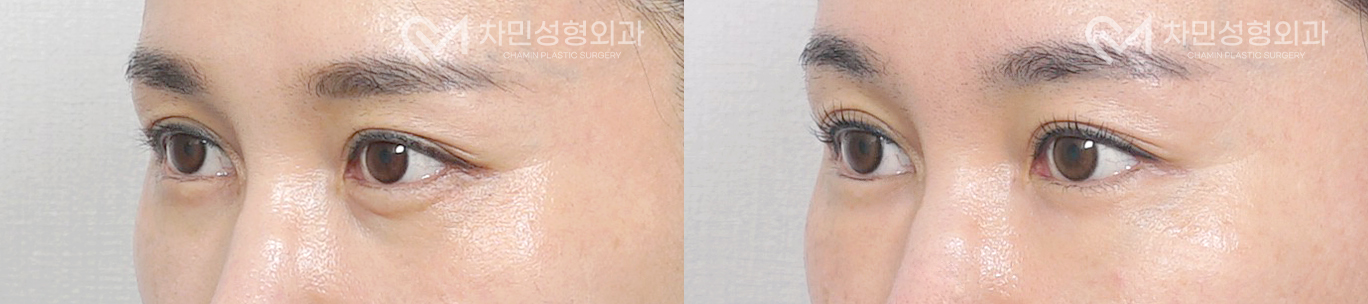 2번째 첨부파일