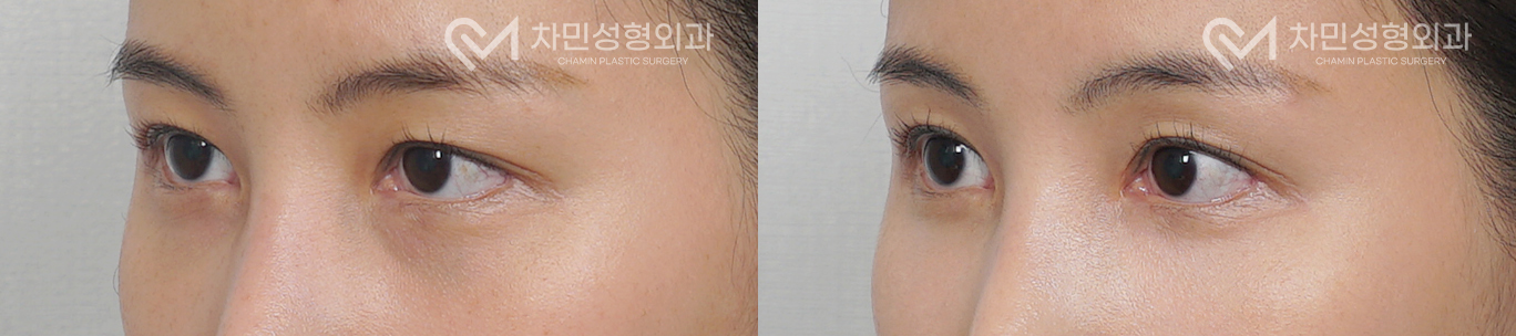 2번째 첨부파일