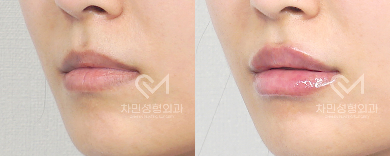 2번째 첨부파일