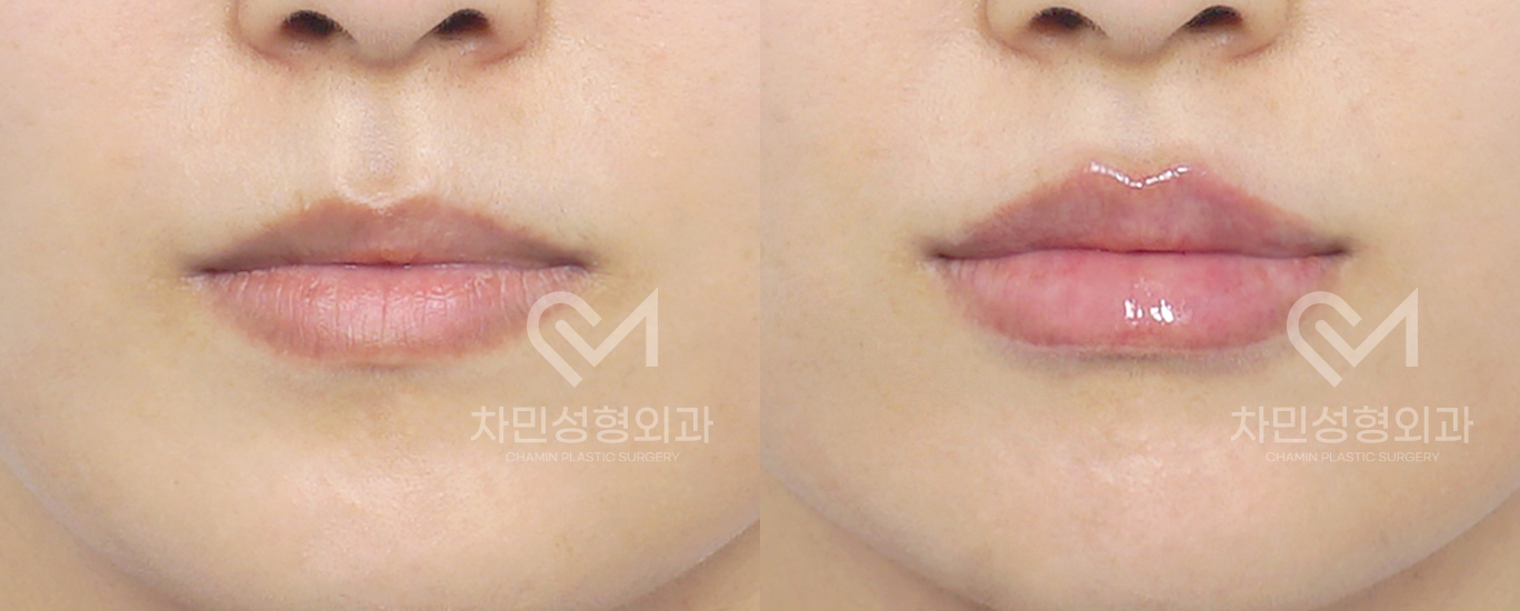 1번째 첨부파일