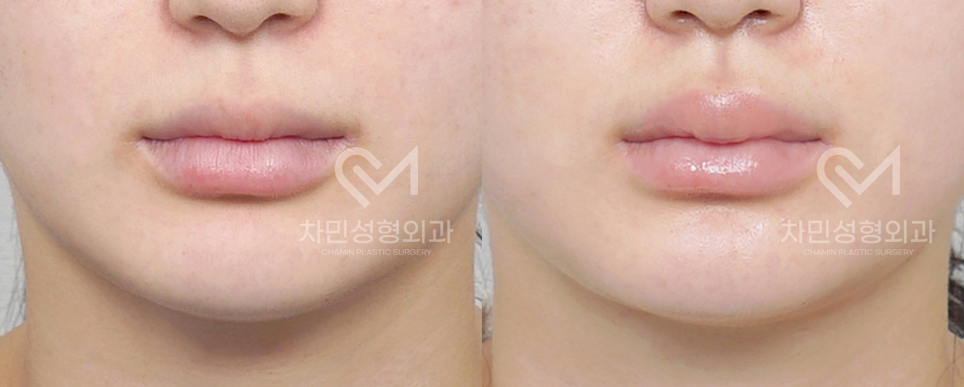 1번째 첨부파일