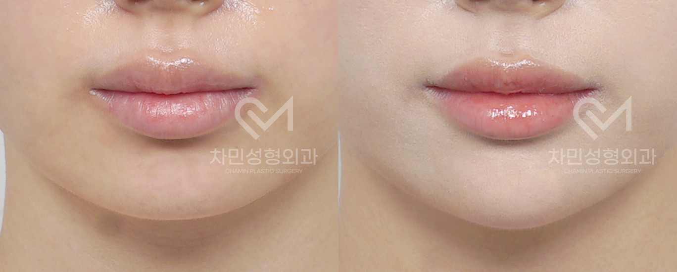 1번째 첨부파일