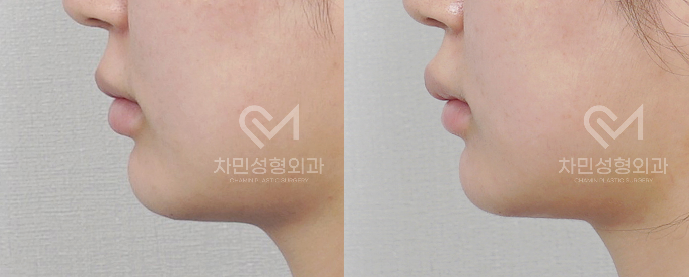 3번째 첨부파일