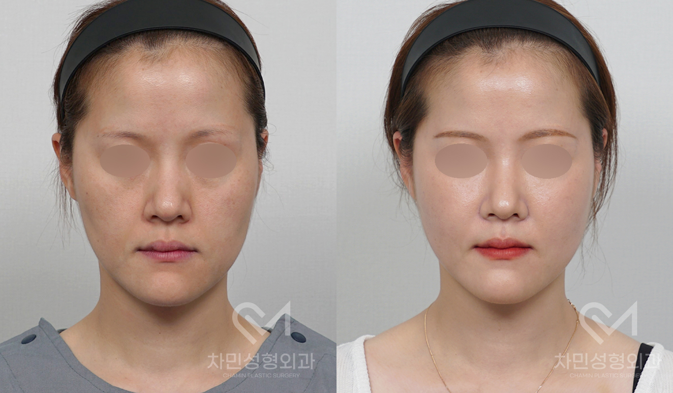 1번째 첨부파일