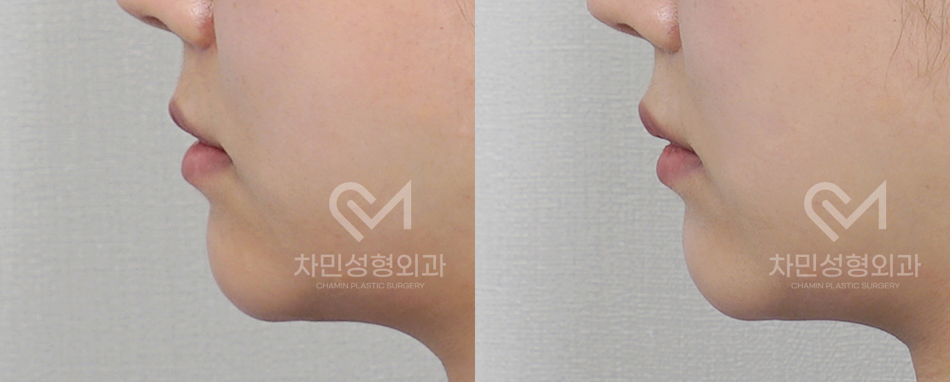 3번째 첨부파일