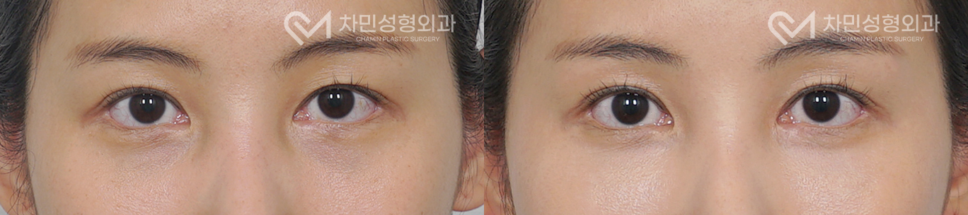 1번째 첨부파일