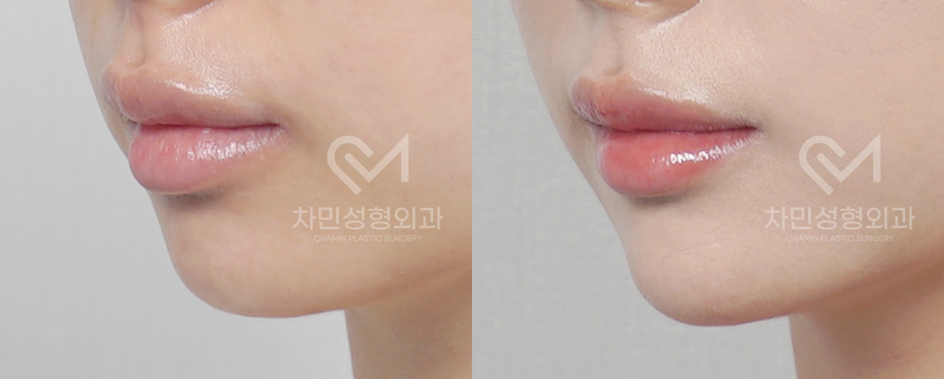 2번째 첨부파일