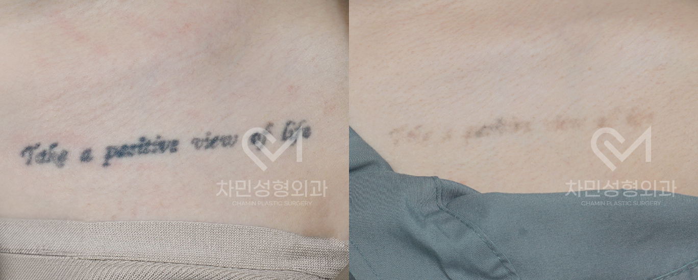 1번째 첨부파일