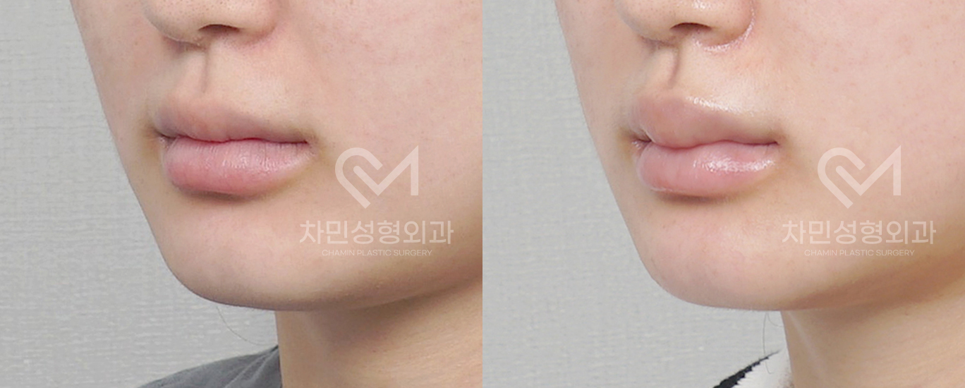 2번째 첨부파일