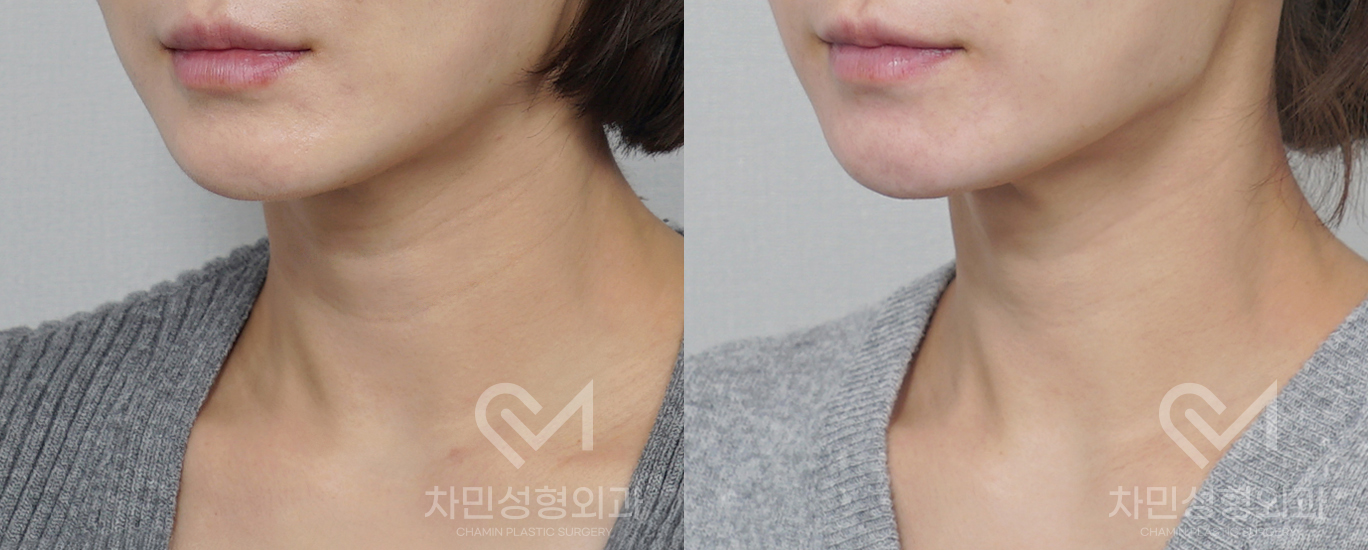 2번째 첨부파일