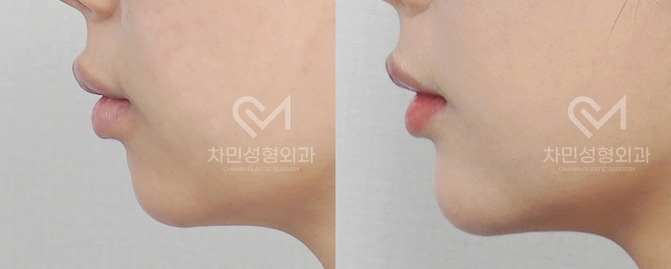 3번째 첨부파일