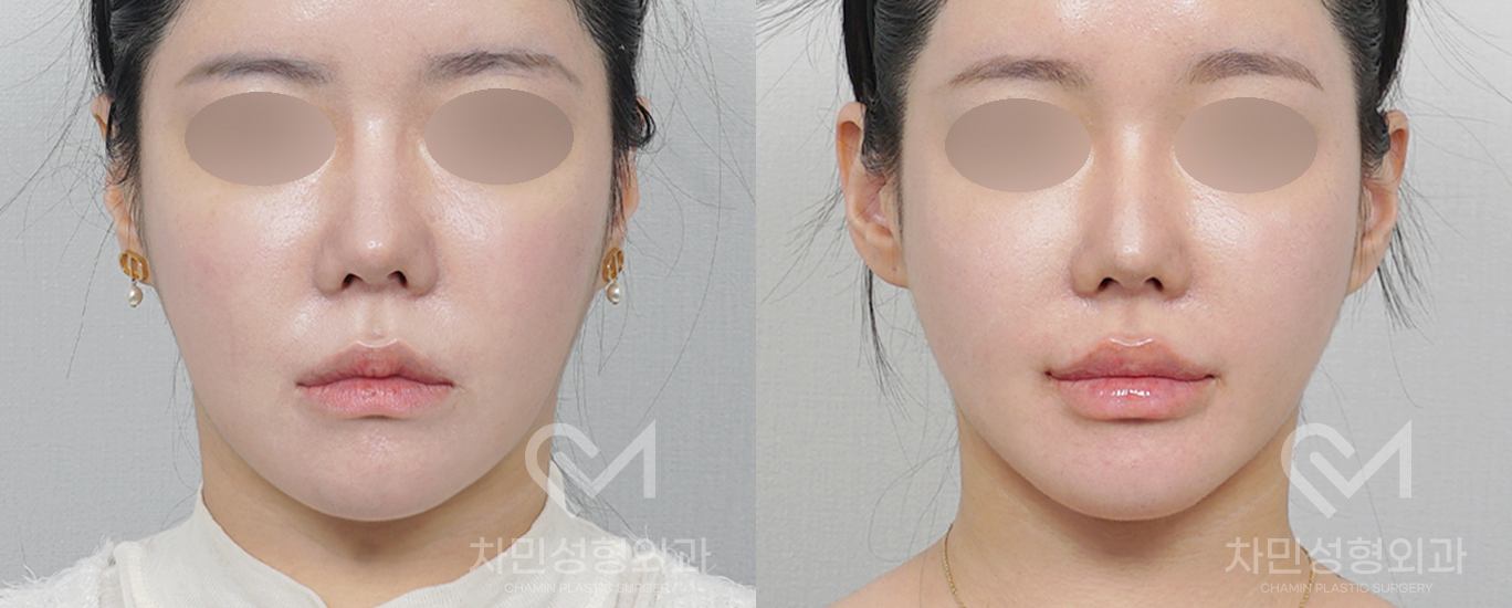 1번째 첨부파일