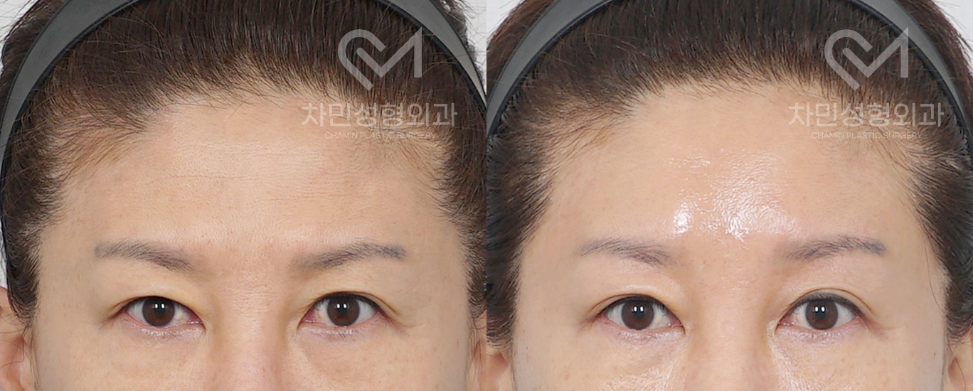 1번째 첨부파일