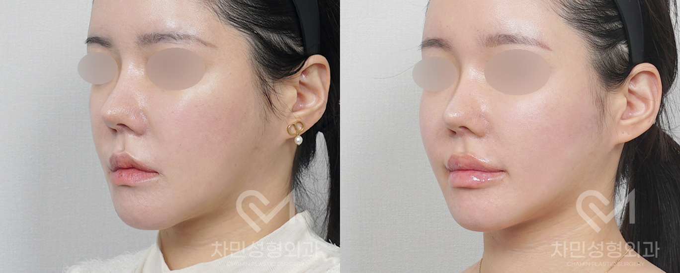 2번째 첨부파일