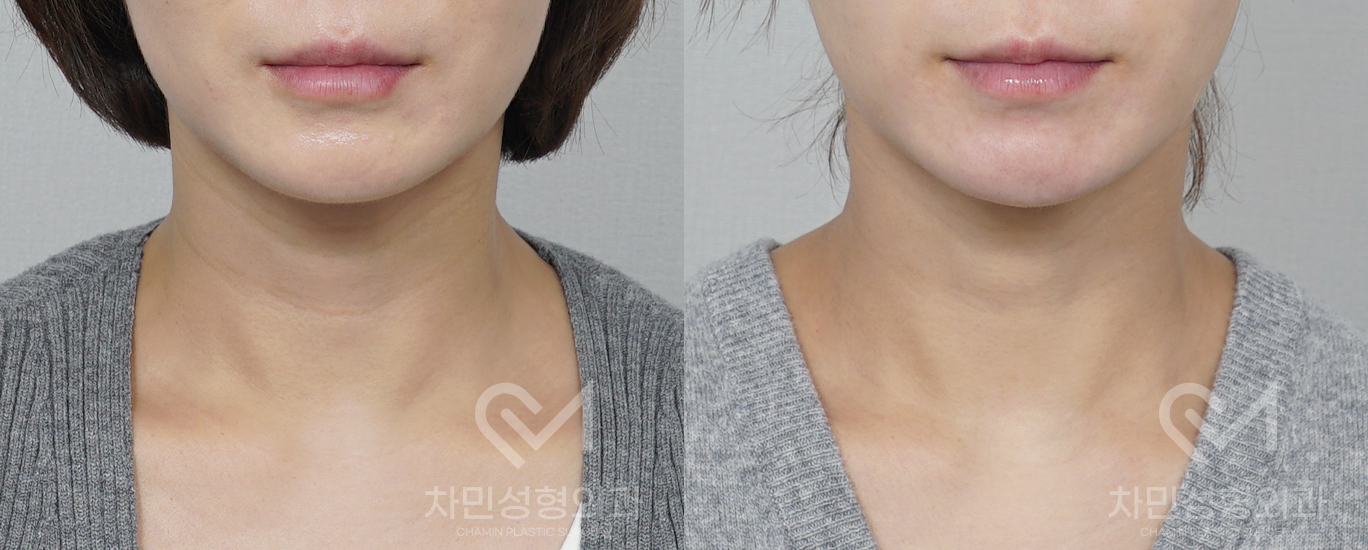 1번째 첨부파일