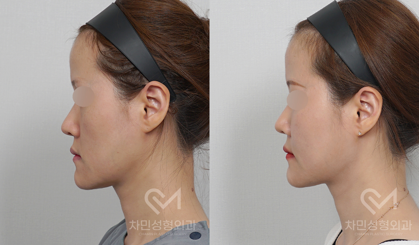 3번째 첨부파일