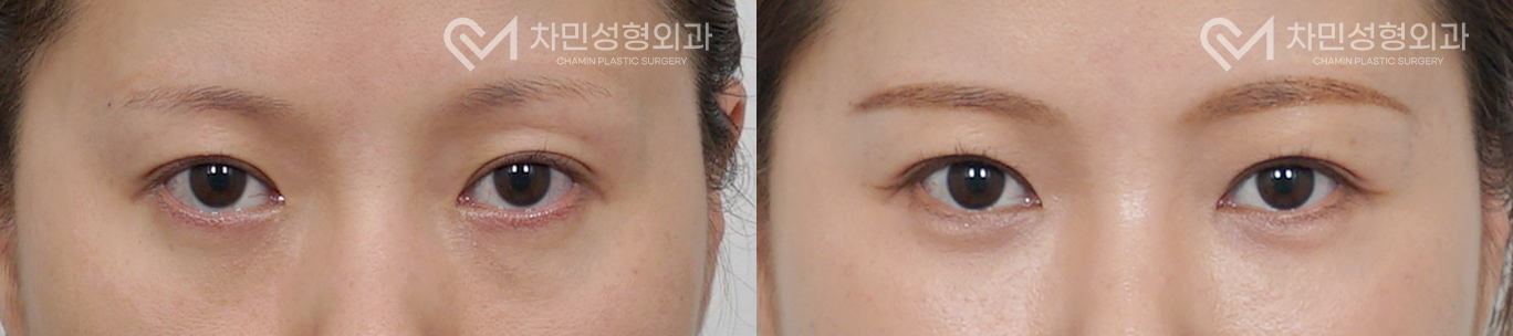 1번째 첨부파일