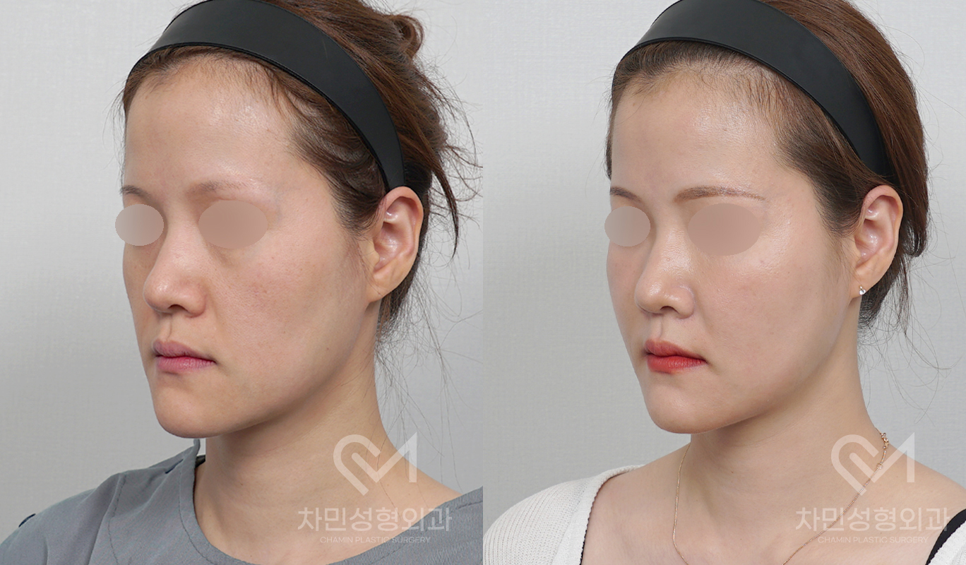 2번째 첨부파일