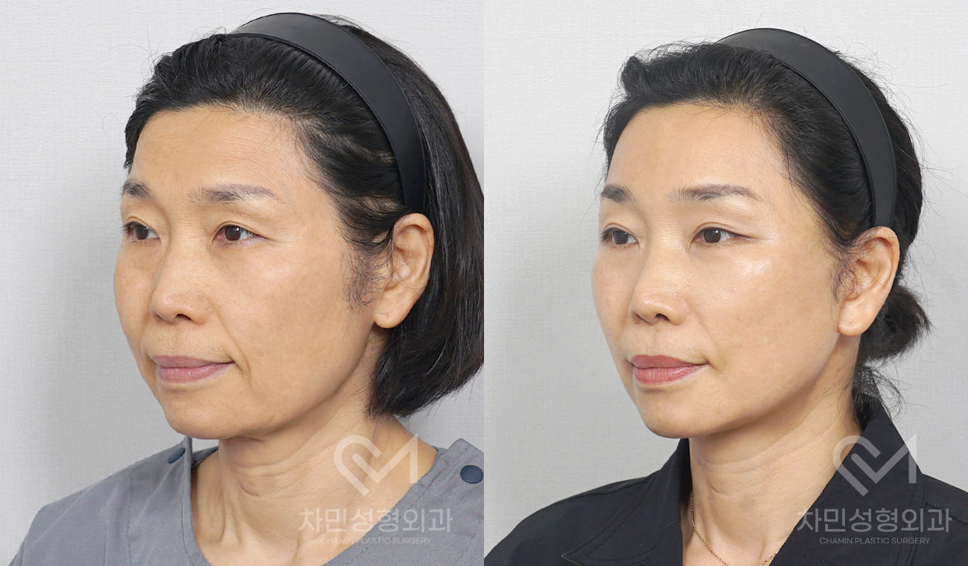 2번째 첨부파일