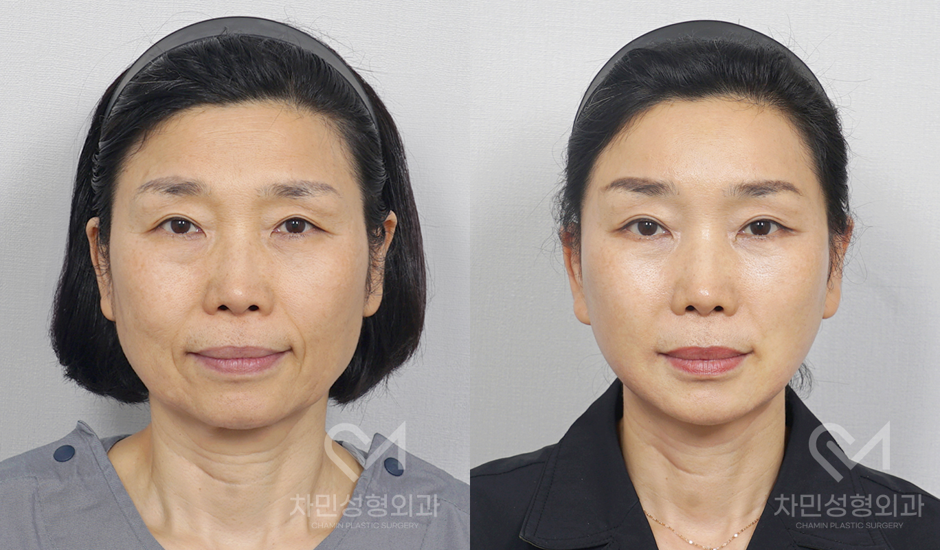 3번째 첨부파일