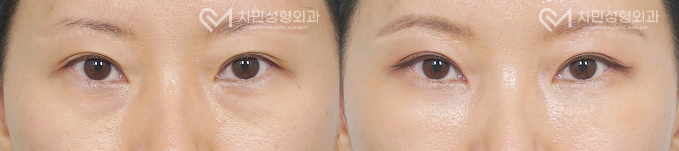 1번째 첨부파일