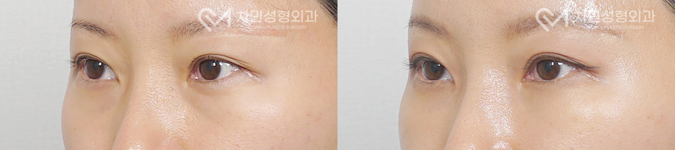 2번째 첨부파일