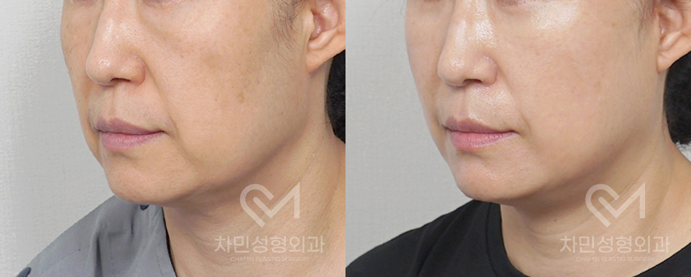 2번째 첨부파일