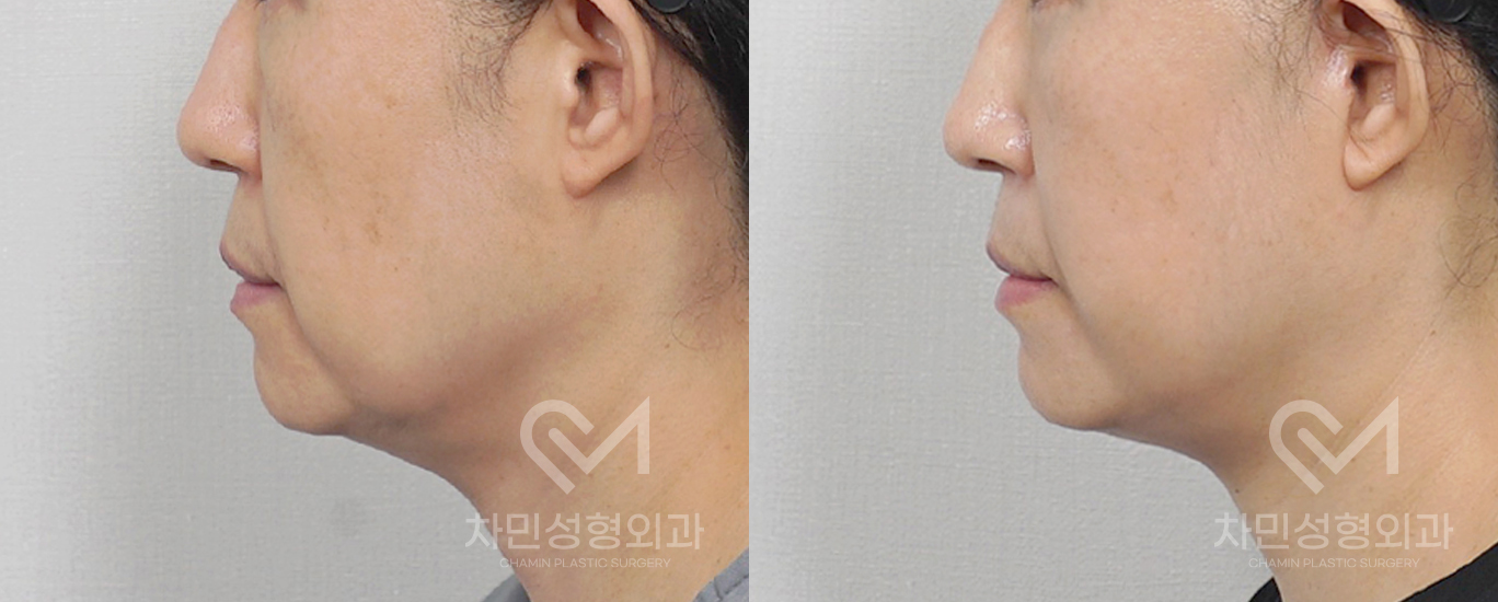 3번째 첨부파일