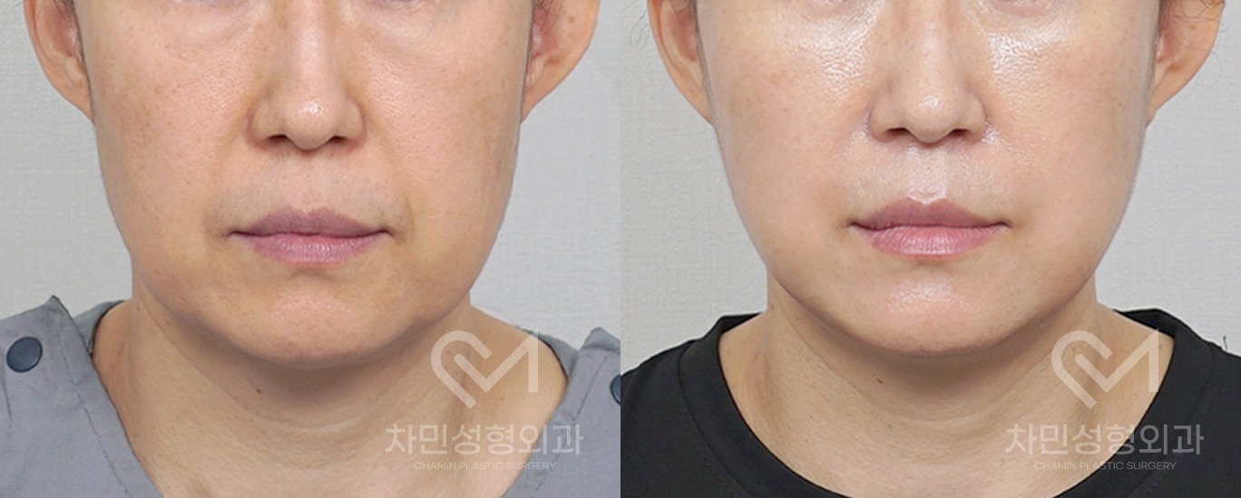 1번째 첨부파일