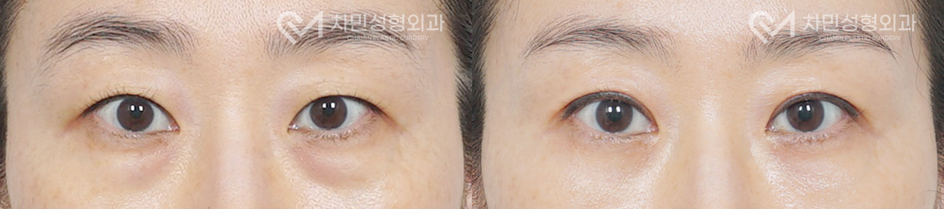 1번째 첨부파일