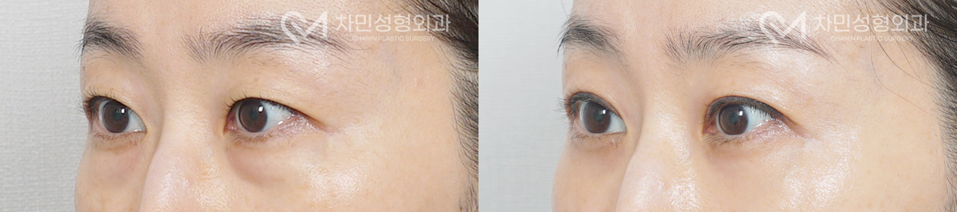 2번째 첨부파일