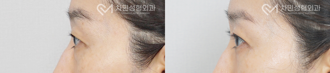 3번째 첨부파일