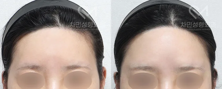 정면